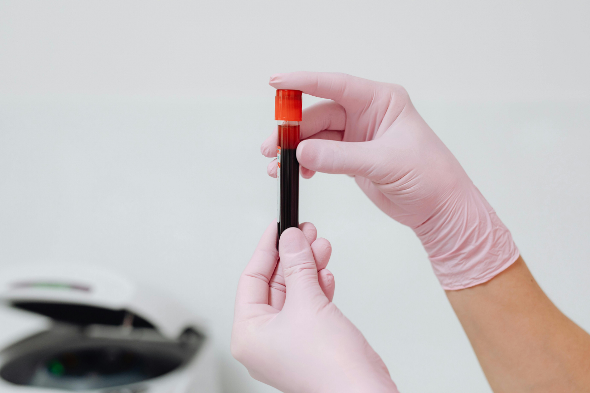 Complete Blood Count Interpretation Online